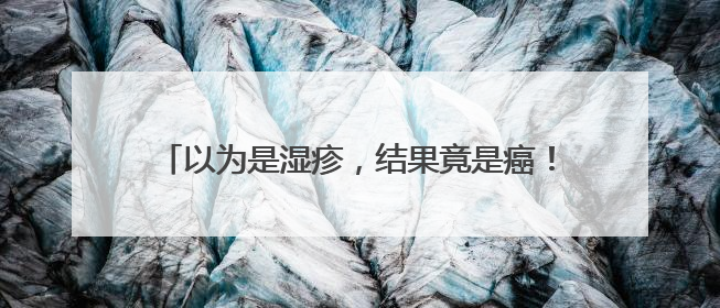 以为是湿疹，结果竟是癌！医生：很多人去错科室！